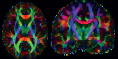 brain scans